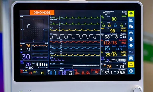 Monitoring equipment